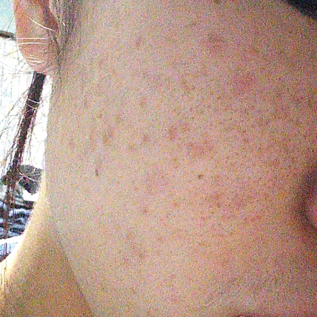 ビタミンc ハードカプセル Dhcの口コミ 2 3枚目汚肌注意 こんにちは 今 By ねこそら 脂性肌 代前半 Lips