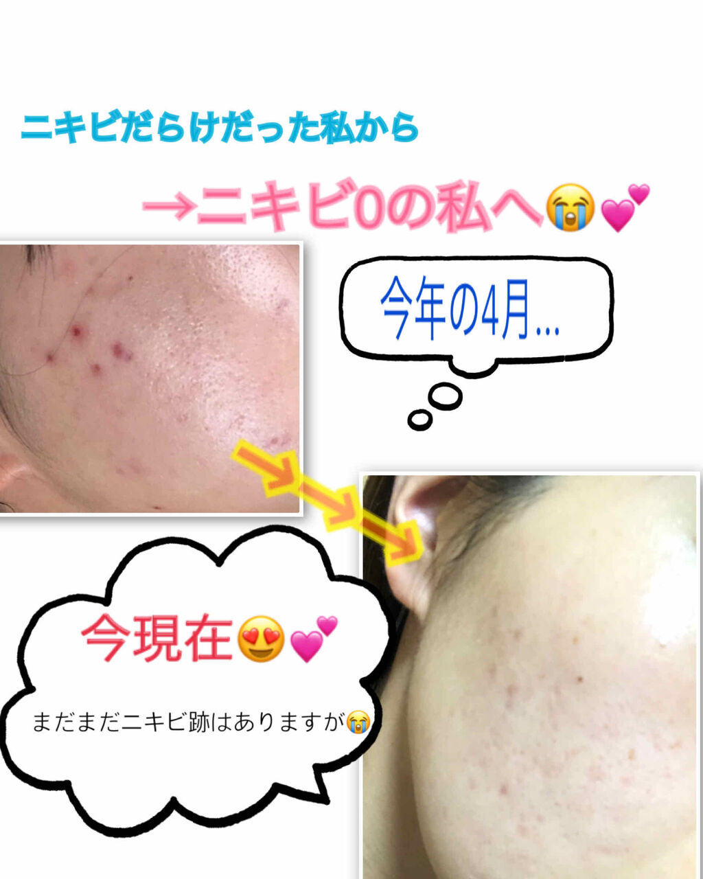 金の青汁 純国産大麦若葉100 粉末 日本薬健の口コミ こんにちは Saoriです 今回は 私のニ By Saori 混合肌 代後半 Lips