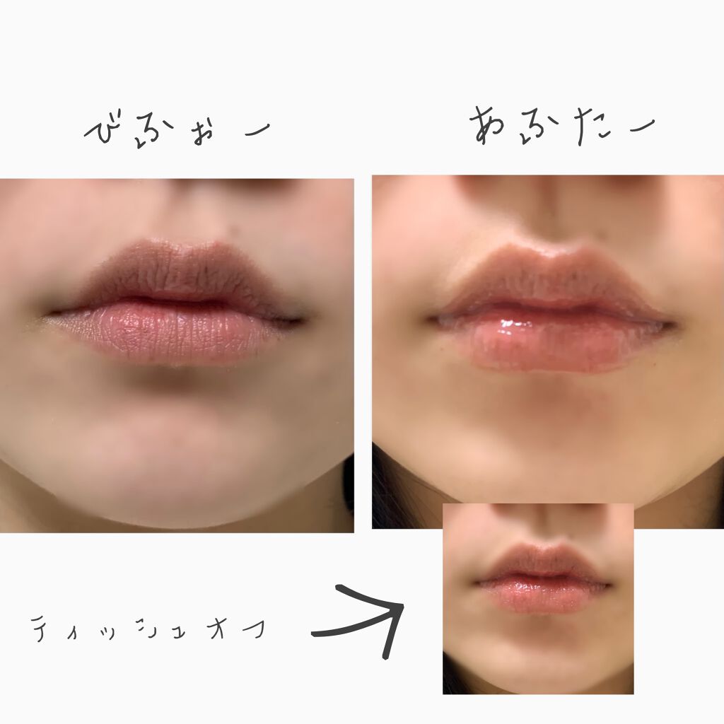 Dotom Lip Plus Plumper Keyboの口コミ Dotomlipplusspringgla By Yukimaru アトピー肌 Lips