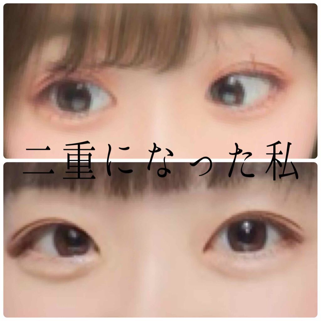 二重になる方法 アイトーク アイトークの使い方や二重メイク 初めまして By みみむむ 混合肌 10代後半 Lips