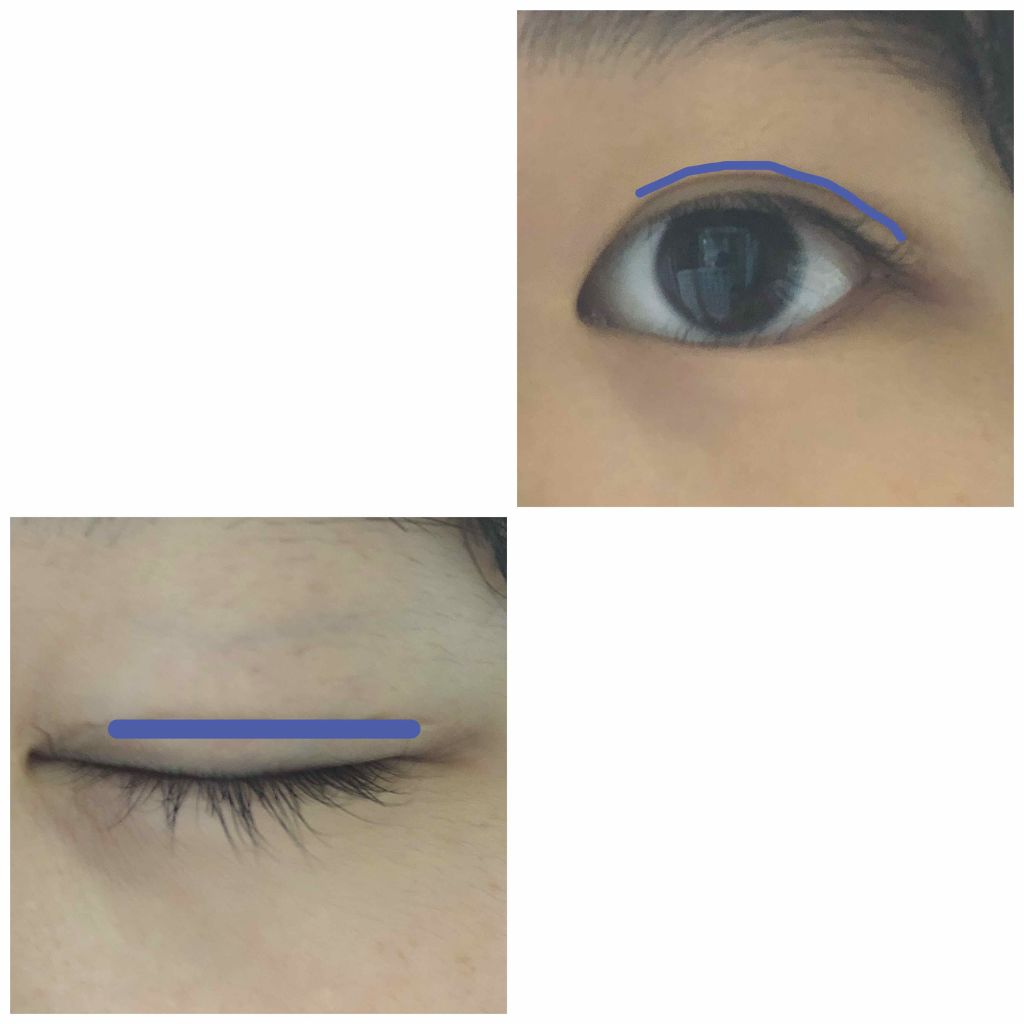 二重になる方法 のび る アイテープ 両面テープタイプ Daisoの使い方や二重メイク 初めまして 私は元は両 By ゆぴ 普通肌 10代後半 Lips