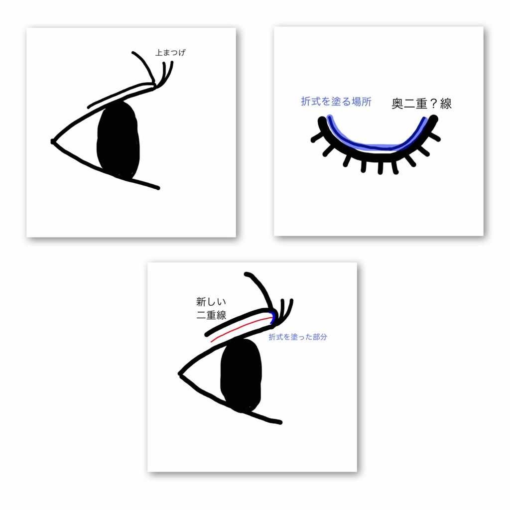 二重になる方法 シングルアイテープ Abの使い方や二重メイク 夜アイプチしたら次の日 By おまめ 脂性肌 10代後半 Lips