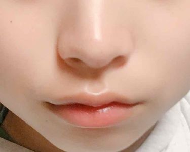 年代 肌質別 天使の優しさ ラッシュの口コミ 454件 Lips