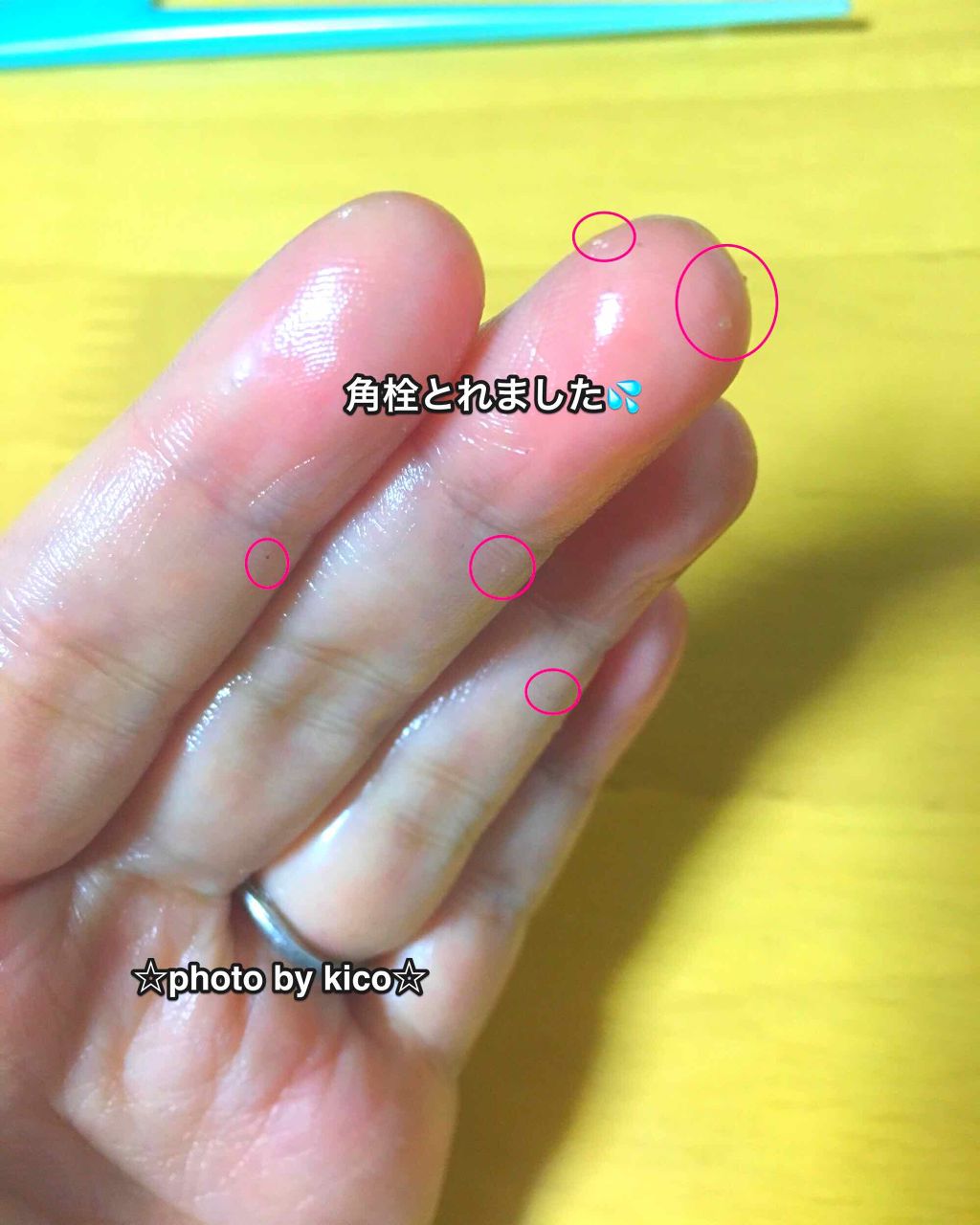 しゃがむ 達成可能 割合 デュオ 角 栓 Navadurga Net