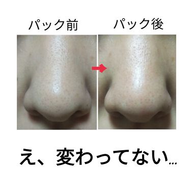 ポア クレンジング パック ファンケルの辛口レビュー 洗い流す毛穴パックレビュー 3枚目鼻の By ひなたま 敏感肌 代前半 Lips