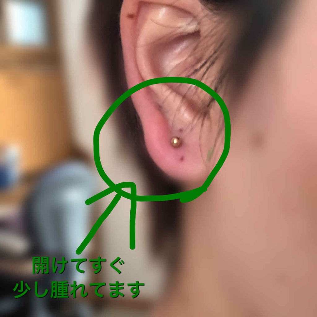 すごい ピアス 消毒 液 ドラッグ ストア 画像ブログ