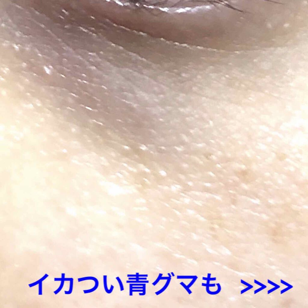ベーシックフォーミュラ S E Covermarkの口コミ 画像後半にイカつい青グマあります カ By Gaho がほ 敏感肌 Lips