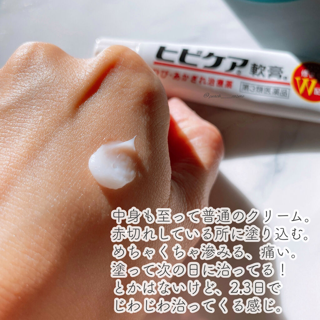 ビューティーチャージ ナイトスペリア アトリックスを使った口コミ 目指せ 白魚のような手𓆛𓆜𓆝𓆞𓆟洗い物やオ By Peach 代後半 Lips