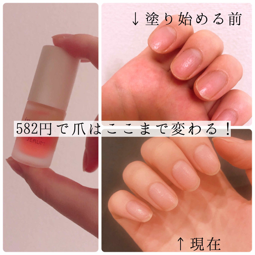 ネイルセラム Innisfreeの口コミ ボコボコな爪 補修したい イニスフリー By Lily 乾燥肌 代前半 Lips