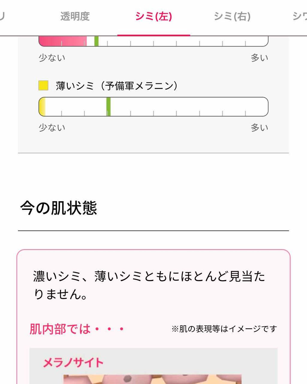 肌パシャ Shiseidoの口コミ コスメではありませんが オススメのアプリで By まーやん 敏感肌 40代前半 Lips