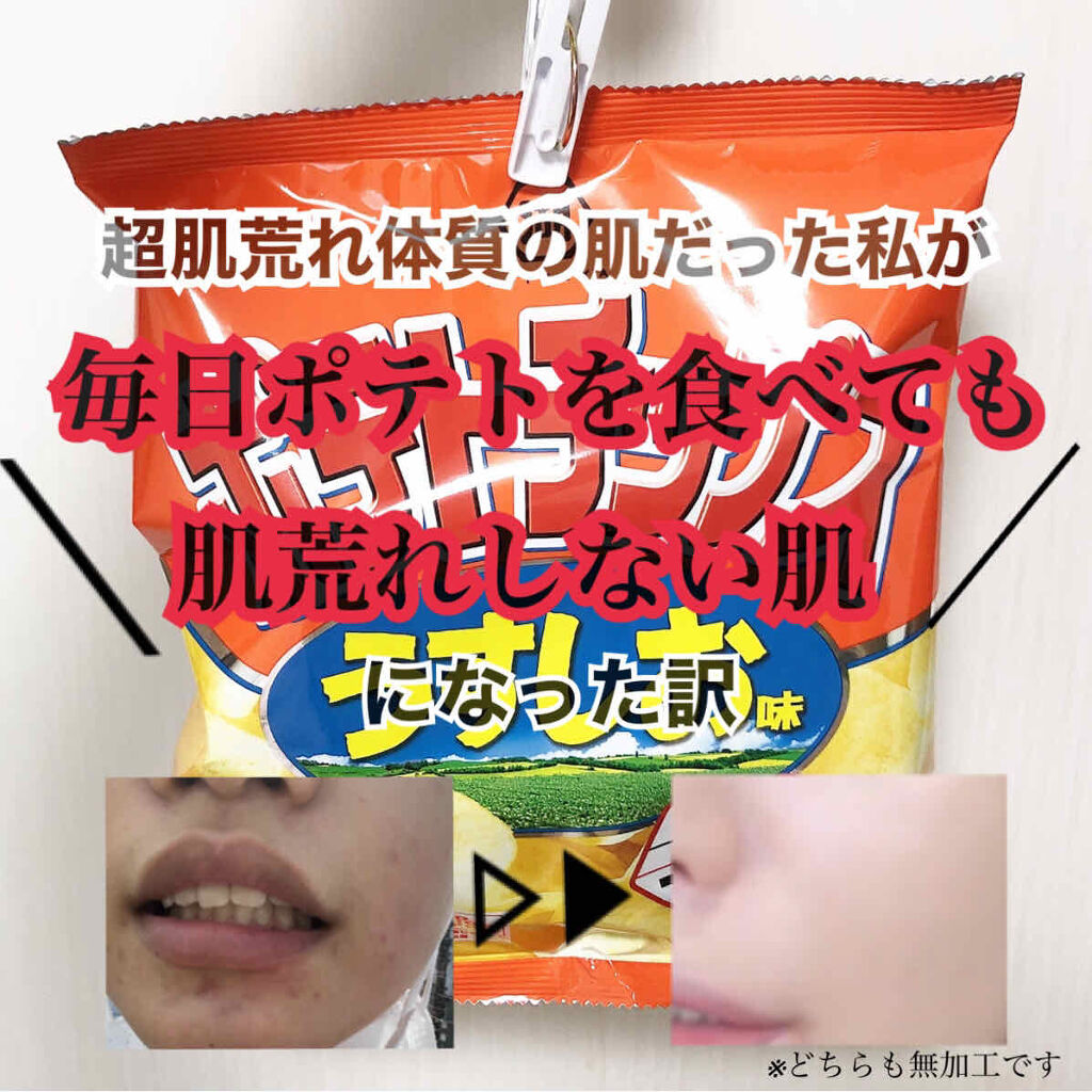 ボルヴィック フルーツキス キリンビバレッジを使った口コミ 超肌荒れ体質だった私がある事をしただけで肌 By Mei7 10代後半 Lips