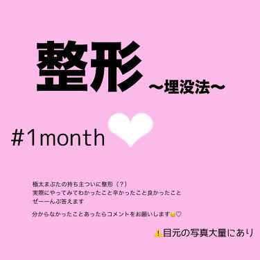 二重になる方法 二重整形の使い方や二重メイク 極太まぶたの持ち主の By ちむ アトピー肌 Lips