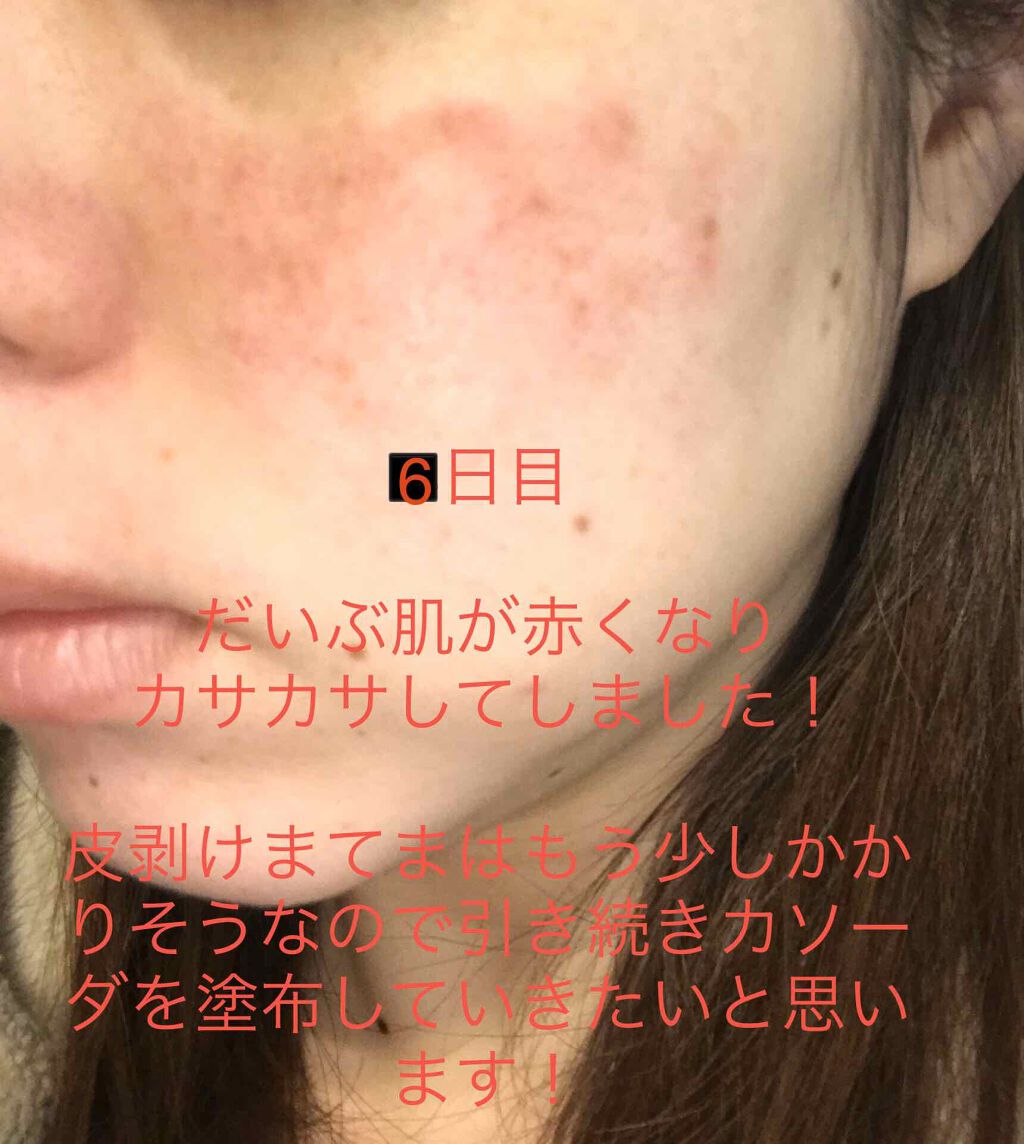 加香ひまし油 医薬品 日本薬局方の口コミ こちらの記事は自身の体験談掲載をしていま By しい 乾燥肌 Lips