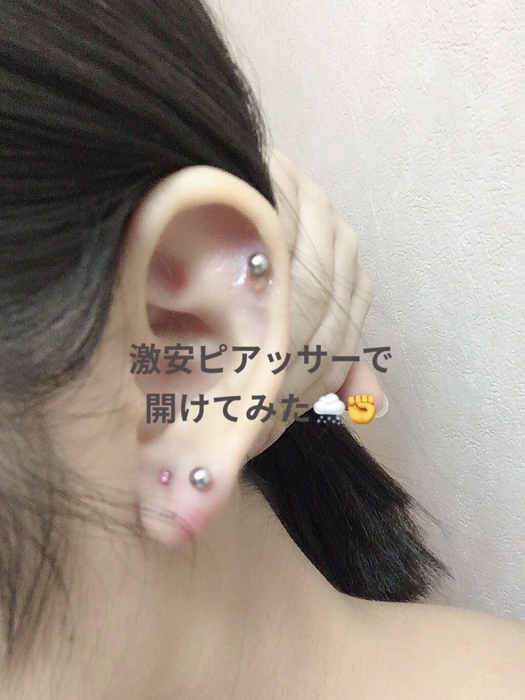 オロナインｈ軟膏 医薬品 オロナインを使った口コミ こんにちは たるです今回は100 0円 By たる 敏感肌 10代前半 Lips