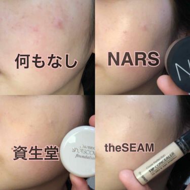 あなたはどっち派 Shiseido Vs The Saem Vs Nars コンシーラーを徹底比較 手持ちでお気に入りのコ By リンコ Lips