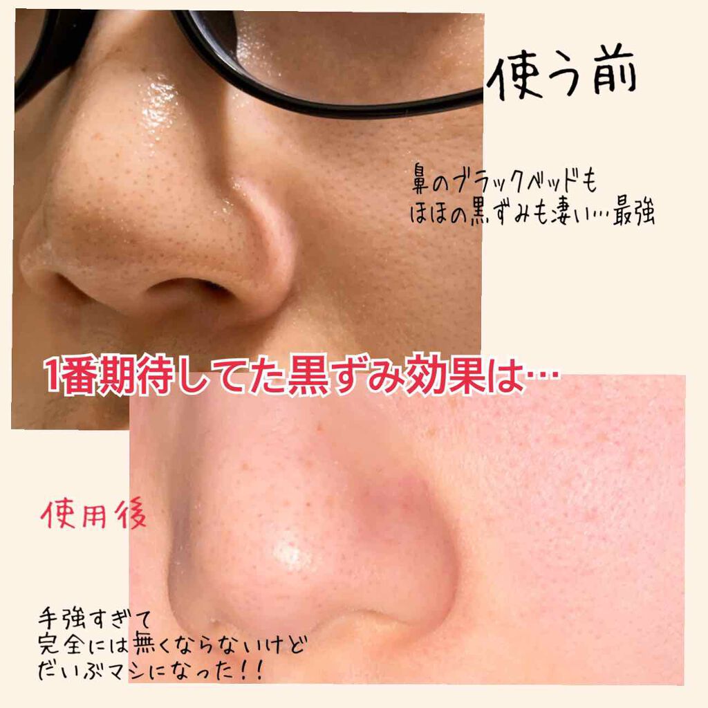 酵素洗顔パウダー 雪肌粋の口コミ 敏感肌におすすめの洗顔パウダー 雪肌粋 酵素洗顔パウ By ばにらうさぎ ʚ ɞ 混合肌 代後半 Lips