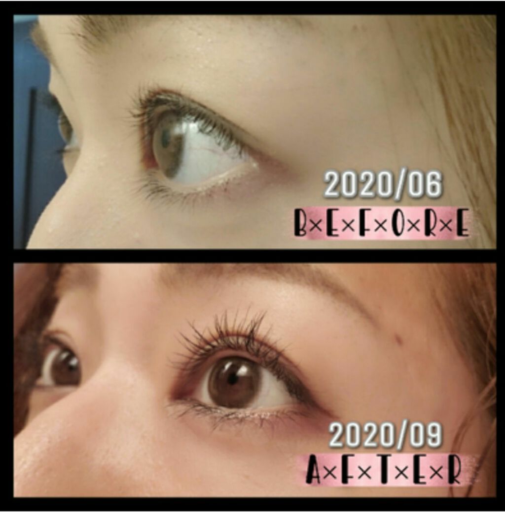 Emaked 水橋保寿堂製薬の効果に関する口コミ Snsなどでも話題のまつげ美容液 エマーキ By たー 普通肌 Lips