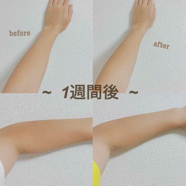 はとむぎエキス Dhcを使った口コミ ハトムギ化粧水 Dhcはとむぎエキスサプ By Ruu 混合肌 10代後半 Lips