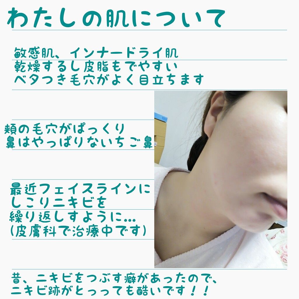 スキンケア方法 美白乳液 W ちふれの使い方 効果 𓃵代olのズボラな By あやなぎ 敏感肌 代前半 Lips