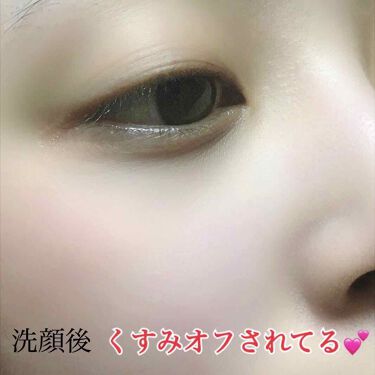 ローズクレイパック Belle Worldの口コミ ローズクレイ洗顔でツルツル美肌 鼻の黒ずみ By Yuna 毎日投稿 乾燥肌 代前半 Lips