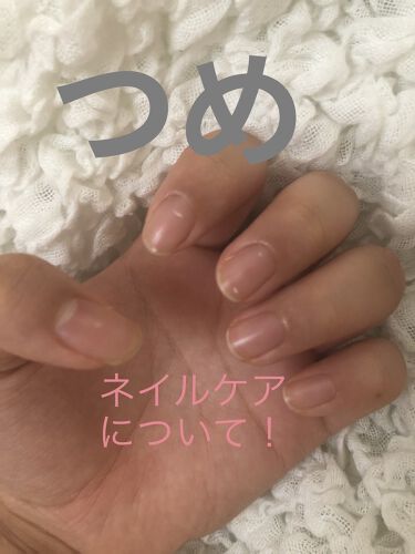 デイケアオイル Dr Nailを使った口コミ 気づいたら色々集まってたネイルケア ハ By 垢抜けたいポテト アトピー肌 10代後半 Lips