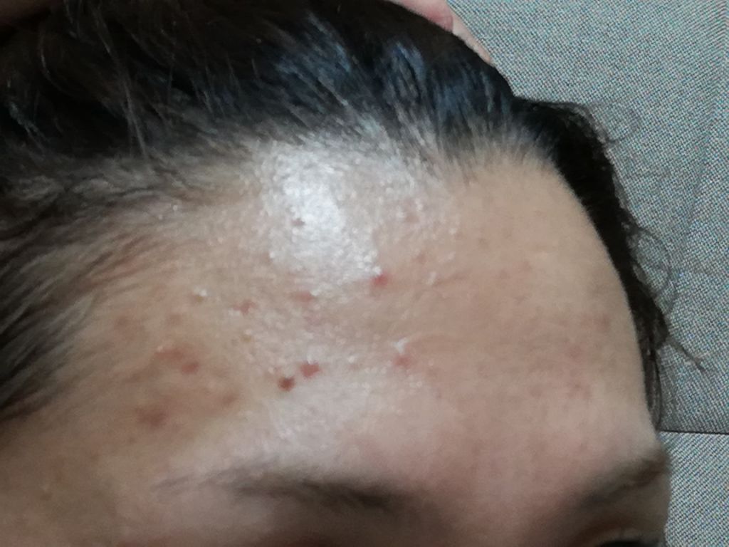 モイストバランス ローション Acseineの口コミ アクセーヌ化粧水の使用経過 2枚目以降 By たいたい Lips