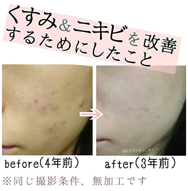 年代 肌質別 ビタミンbミックス Dhcの口コミ 303件 Lips