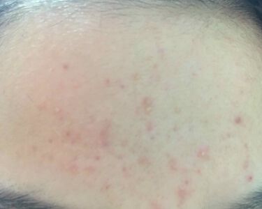 桜島火山灰配合せっけん ユゼ化粧品のリアルな口コミ レビュー Lips