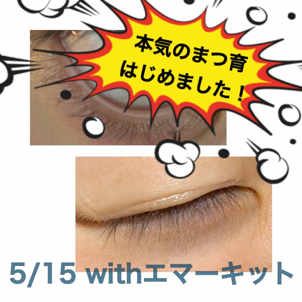 深い 池 機関 エマーキット 激安 Mitochon Jp