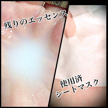 Mask Sheet It S Skinの効果に関する口コミ エイジングケアにおすすめのシートマスク パック It Sskinth By Chanel Chan 延命治療中 混合肌 Lips