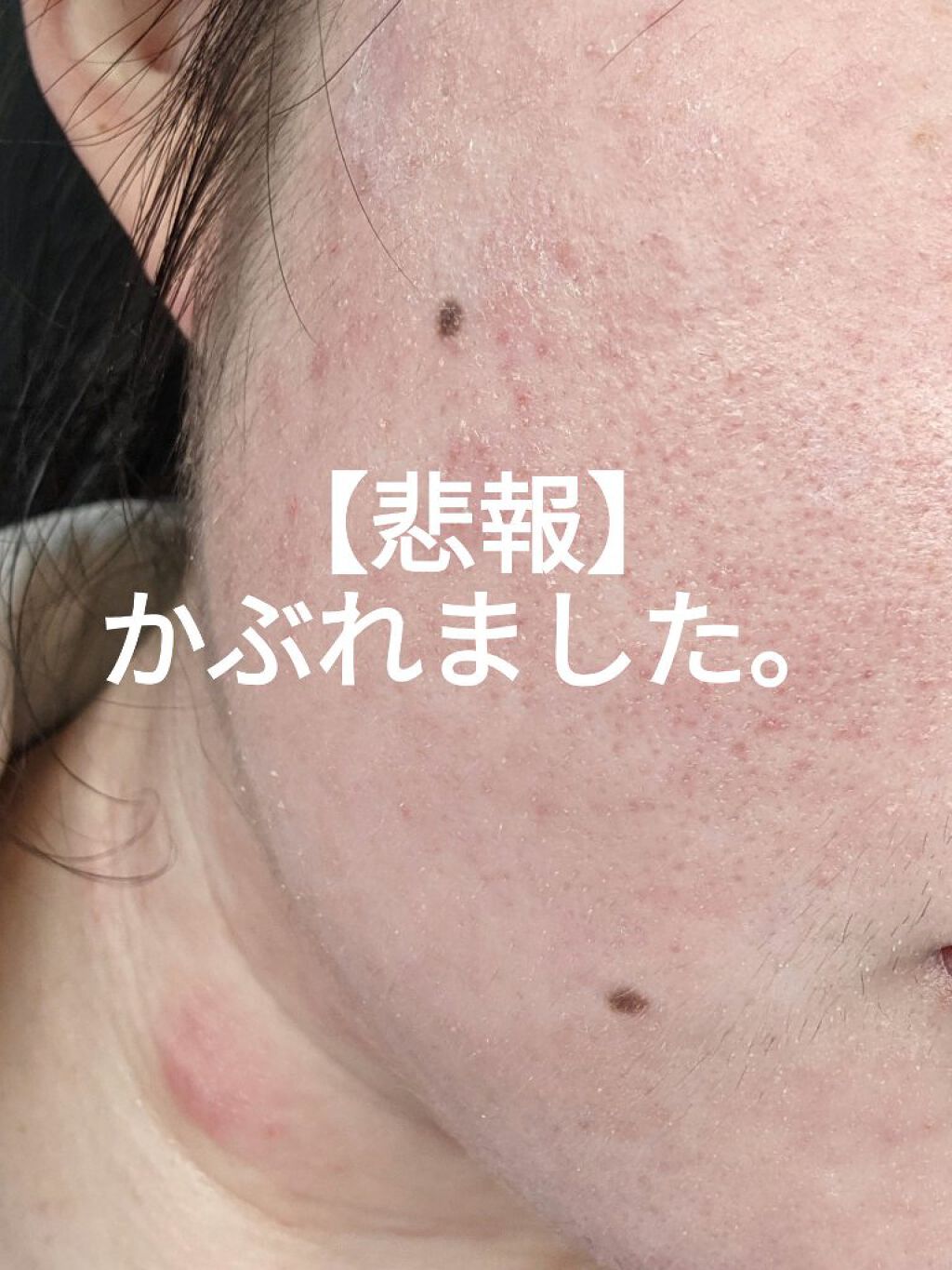 セラネージュ Uvクリーム Ceralaboの口コミ かぶれました 首からフェイ By まいなん 敏感肌 代後半 Lips