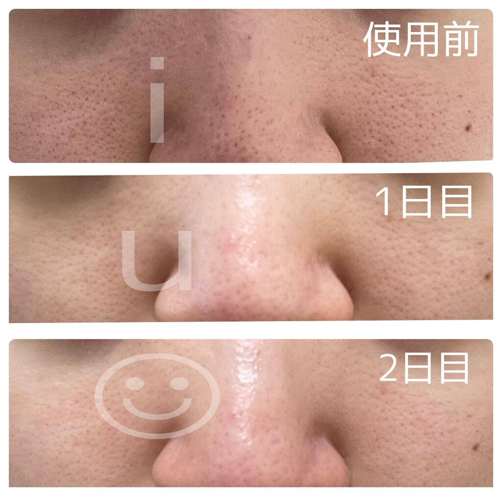 グリーンティーシード セラム Innisfreeを使った口コミ 2枚目 毛穴のビフォーアフター写メありま By Iu フォロバ 乾燥肌 Lips