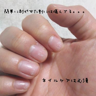 ウィークリージェル Homeiを使った口コミ Homeiウィークリージェル 浮いてきた By りーさん 混合肌 30代前半 Lips