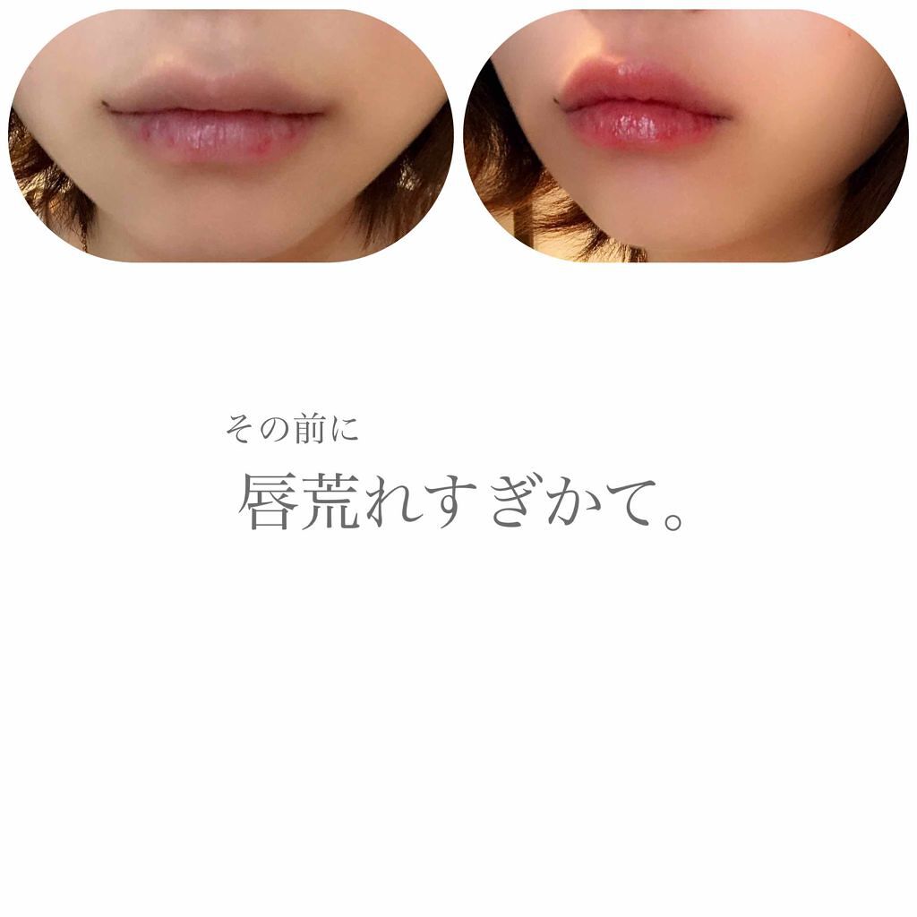 年代 肌質別 口紅 詰替用 ちふれの口コミ 11840件 Lips