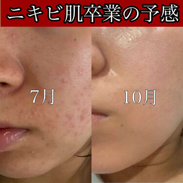 年代 肌質別 Pブースター Cnp Laboratoryの口コミ 1137件 Lips