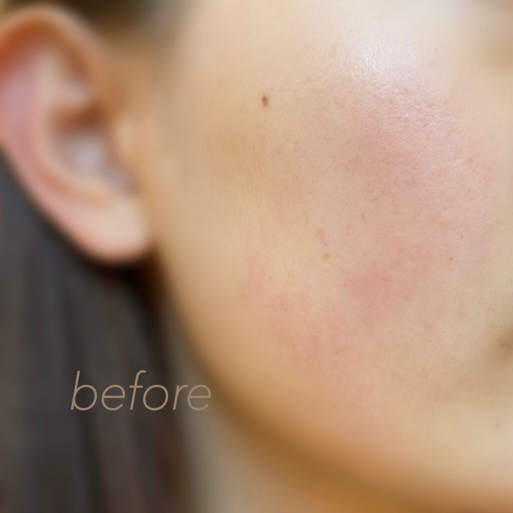 Ts ジェリフルブラーバーム Etudeの口コミ 顔の赤みを本気で消したい方へ By ちゃんぬー 脂性肌 代前半 Lips