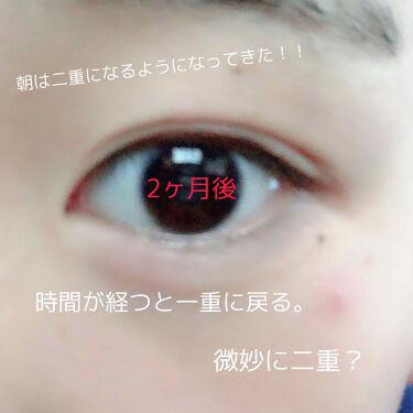 ナイトアイボーテ Streetrendの口コミ ナイトアイボーテを徹底検証してまたした 二 By ぴ円丸 乾燥肌 10代前半 Lips