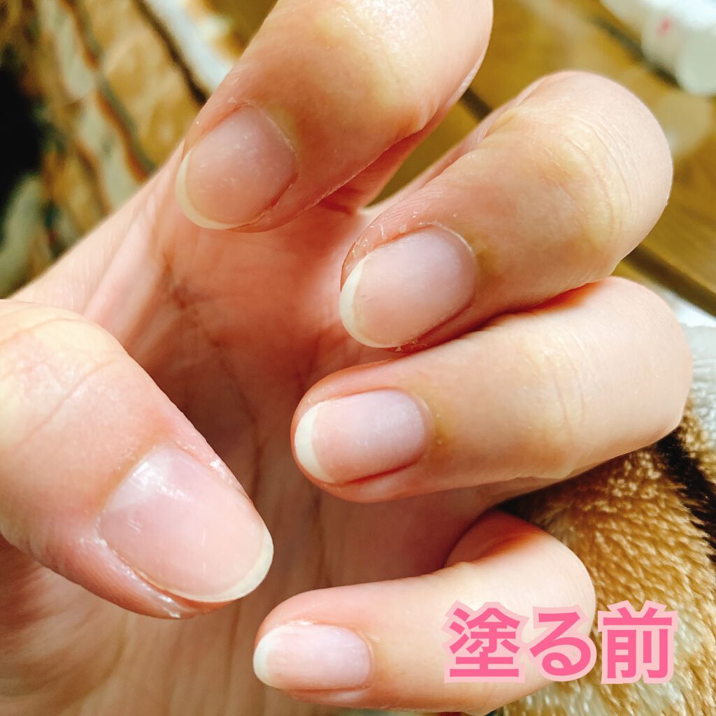 デイケアオイル Dr Nailを使った口コミ 一旦ジェルネイルをお休みしたくてオフしてき By みみみ 混合肌 代後半 Lips