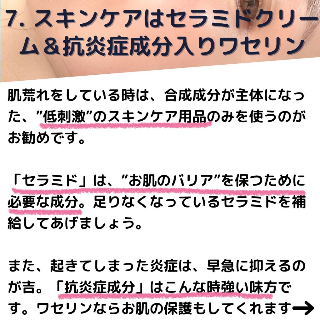 スキンケア方法 潤浸保湿フェイスクリーム キュレルの使い方 効果 肌荒れ治らない時に試す By Mimi スキンケアオタク 美容愛好家 敏感肌 30代後半 Lips