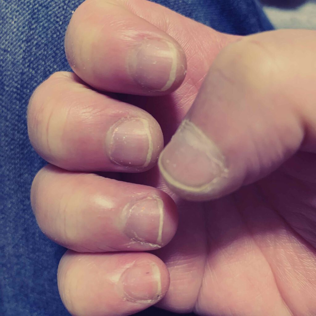 1秒ネイルマジックプレス Dashingdiva Magicpressの口コミ 仕事上 水を使うので手荒れ酷いですが か By たんれい 脱爪噛み 脂性肌 30代前半 Lips