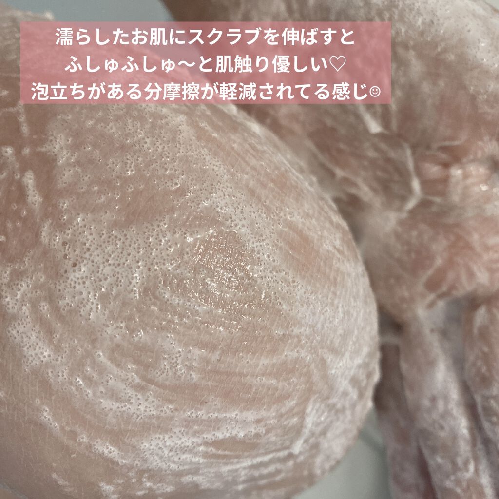 ソルティスクラブ エステニーの口コミ つるぷりなおしりとあわよくば肘と膝の黒ずみ By Shibumin 乾燥肌 30代前半 Lips