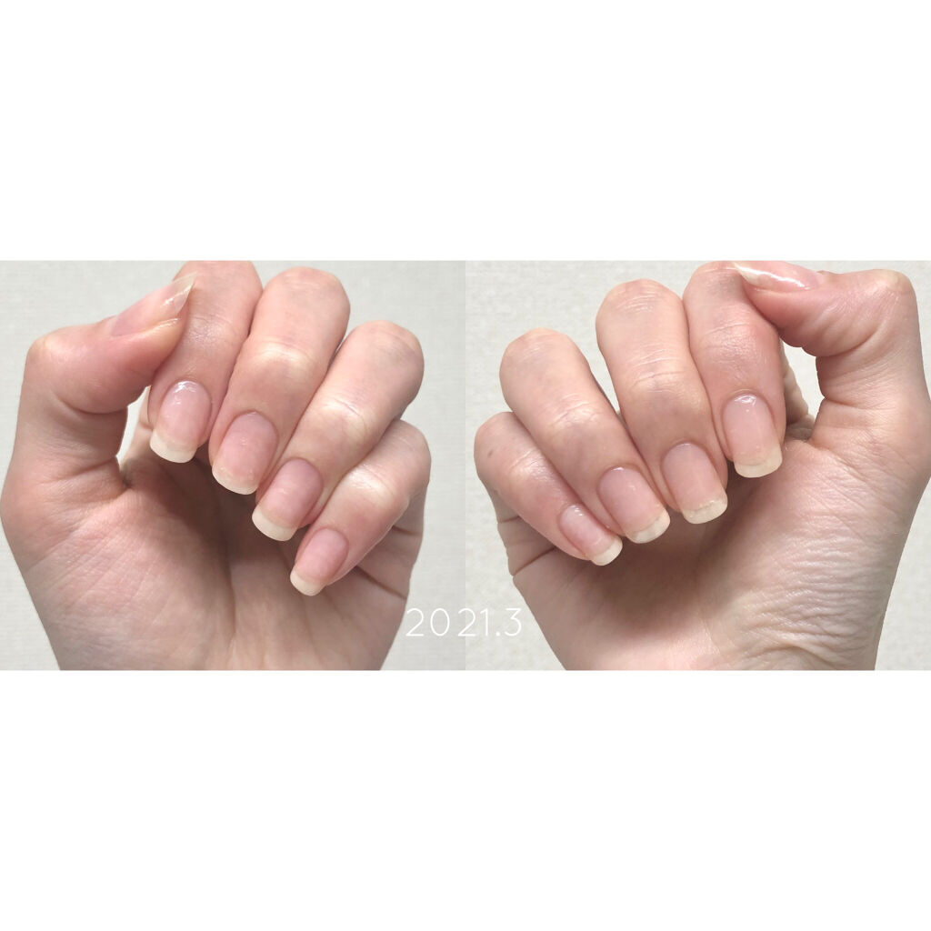 スウィートアーモンドオイル 無印良品の口コミ 育爪経過報告 2月 3月ついにセルフネイ By てらお 敏感肌 代後半 Lips
