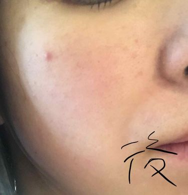 スキンケアパウダー 素肌記念日の口コミ サナ素肌記念日スキンケアパウダー すっぴん By おつきみやま 混合肌 代後半 Lips