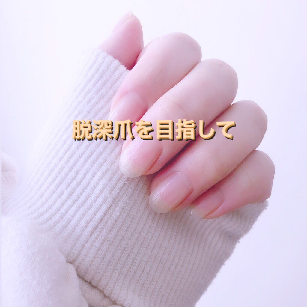 クイックケアコート Ettusaisを使った口コミ 今回は私の爪事情についてです 私は小さい頃 By Milky 10代後半 Lips クイックケアコート Ettusaisを使った口コミ 今回は私の爪事情についてです 私は小さい頃 By Milky 10代後半 Lips