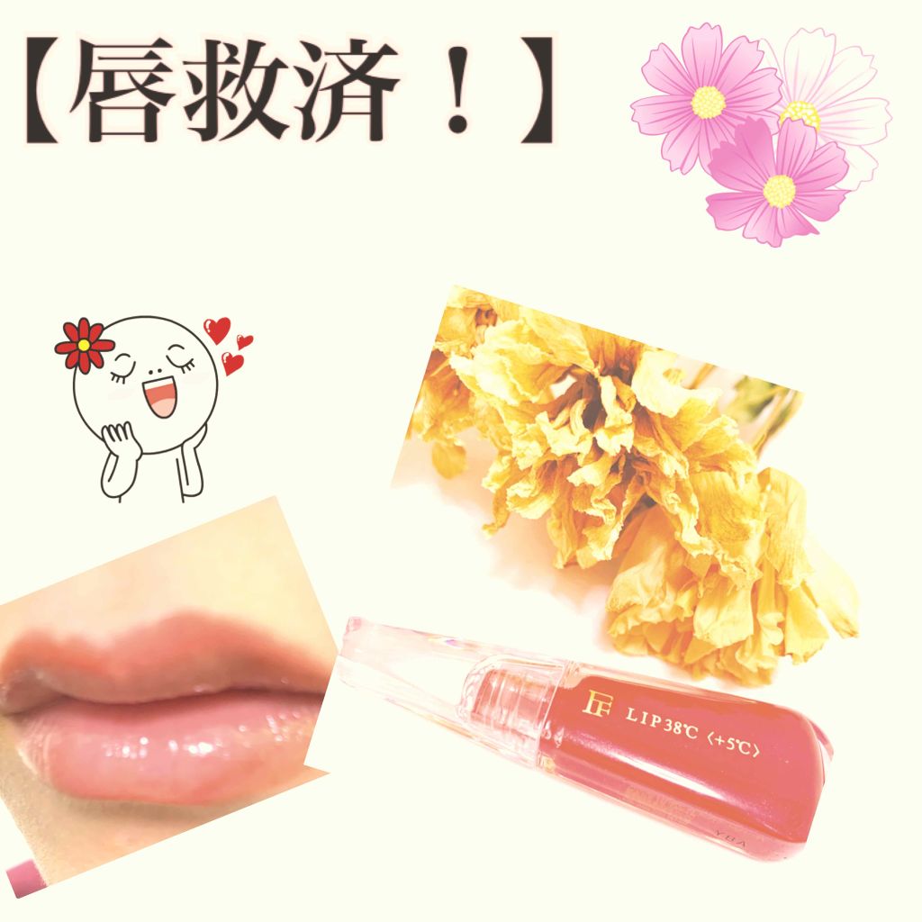 38 C 99 F Lip Treatment Uzu By Flowfushiの口コミ 色素沈着で荒れた人必見 最近某リップ By なーちゃんフォロバ0ぱーせんと 乾燥肌 代前半 Lips