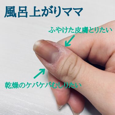 キューティクルニッパー デュカートを使った口コミ 甘皮処理 社会人になってからやってるのです By Ayo 普通肌 代後半 Lips