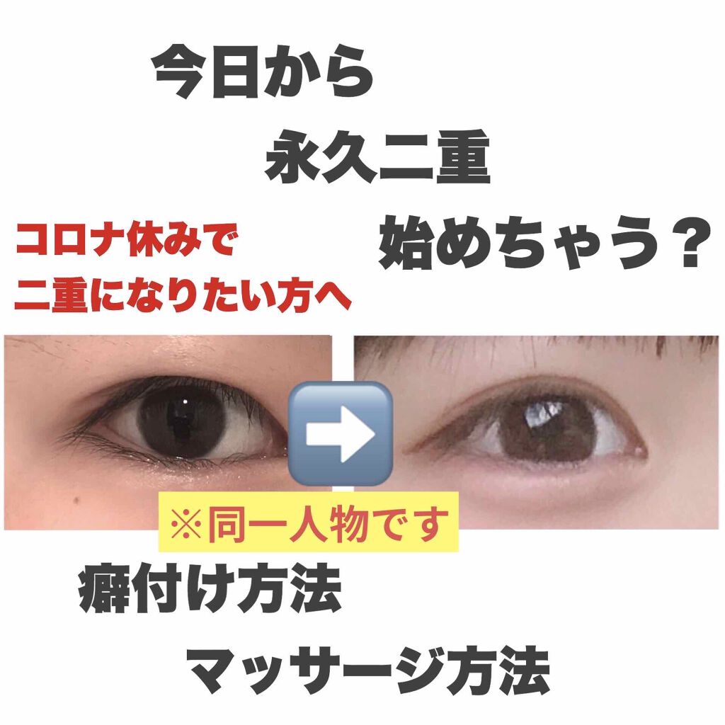 二重になる方法 のび る アイテープ 絆創膏タイプ Daisoの使い方や二重メイク 二重活動始めませんか By よんひ 混合肌 10代後半 Lips