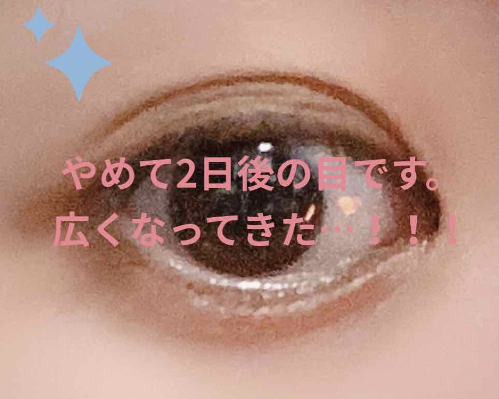 ルドゥーブル ルドゥーブルを使った口コミ アイプチやめたとたん二重になった 一年間ア By になさん Lips