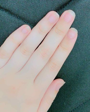 ハンドベール プレミアムリッチネイル メンソレータムを使った口コミ 前回の爪噛みの話を書いてから1ヶ月経ちまし By 蒼 乾燥肌 代後半 Lips