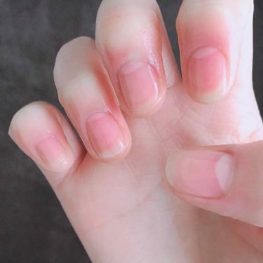 Ac キューティクルオイル Ac Makeupの使い方を徹底解説 はじめての投稿はじめまして ガタガタ爪だ By Fresh Sounds T5q 乾燥肌 10代後半 Lips